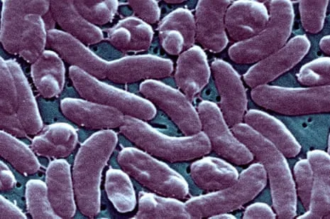 The Bayou State Reports 5 Fatalities from Necrotizing Bacterium in Coastal Seawater